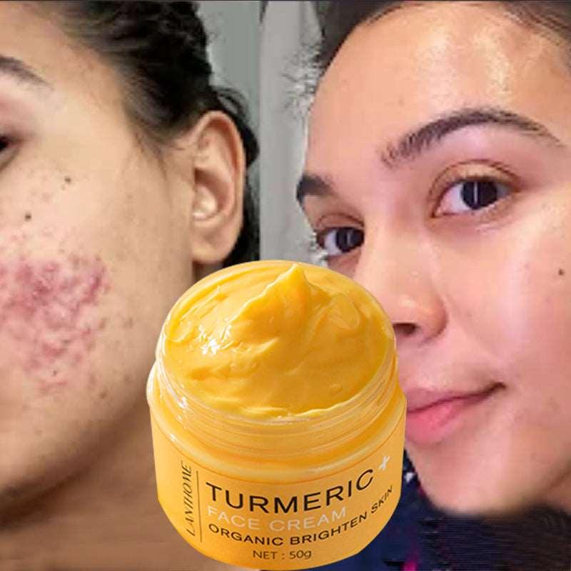 Radiant Glow Turmeric Cream: Clear Skin & Brighten Complexion